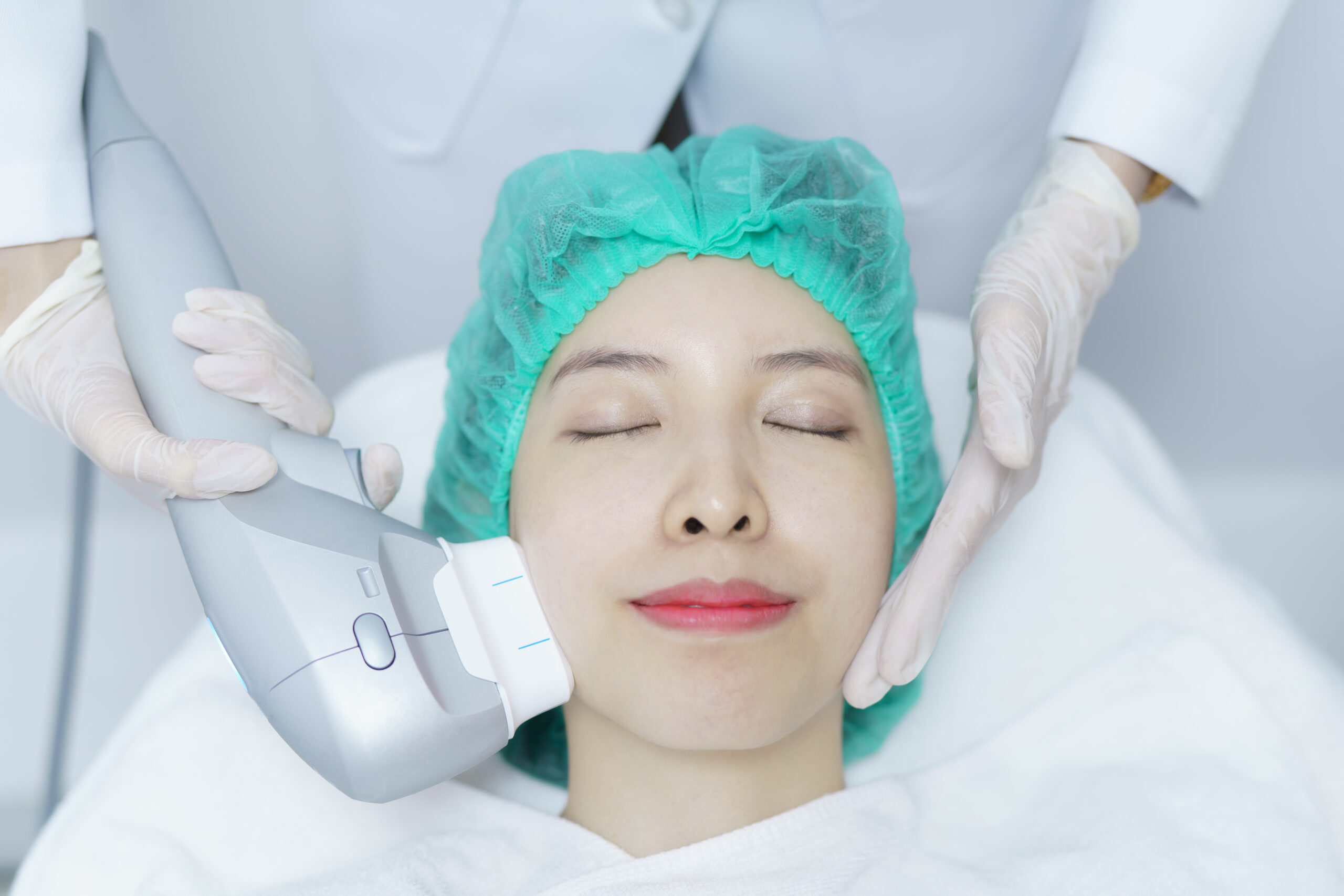 woman getting IPL treatment